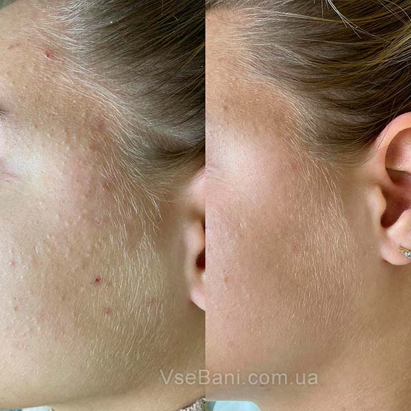 Белые угри Белые угри