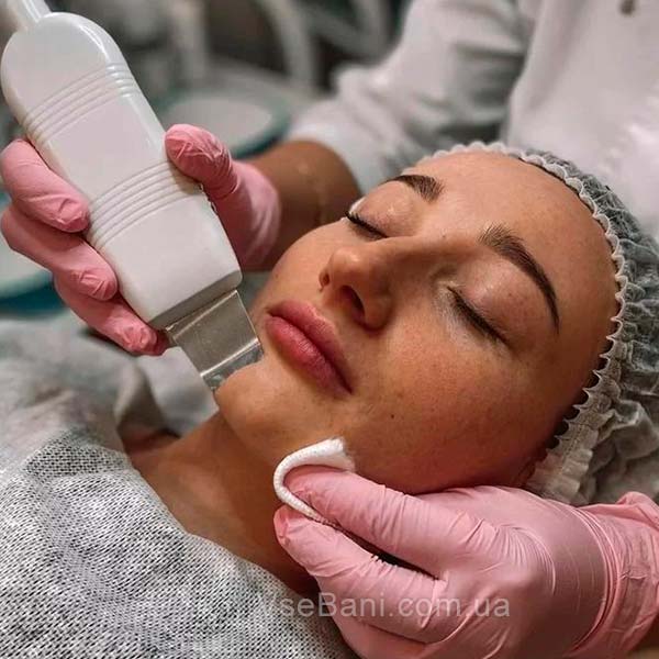 Вульгарные угри лечение