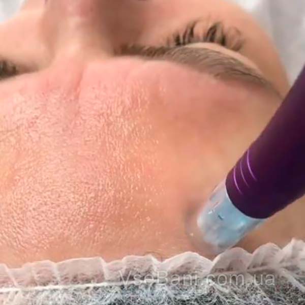 Как убрать черные точки с подбородка. Чистка у косметолога