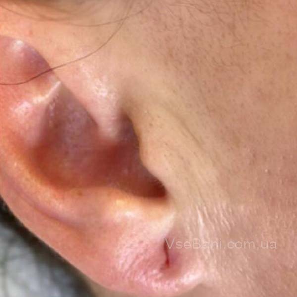 как убрать черные точки в ушах как убрать черные точки в ушах