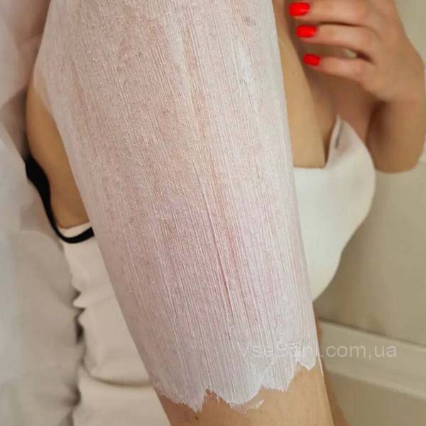 Пузырьковая сыпь на руках как избавиться в домашних условиях