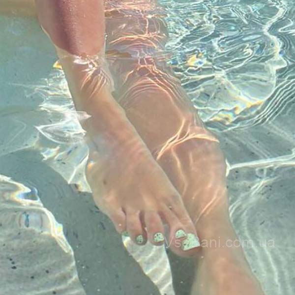 Как предотвратить появление сыпи на ногах