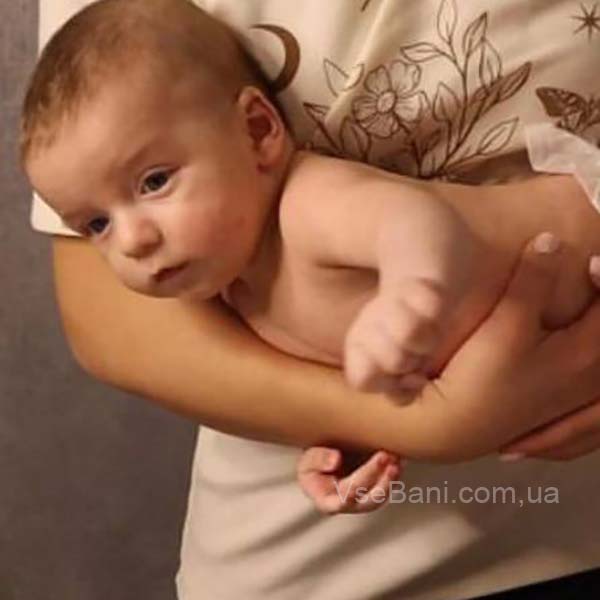 Мелкая сыпь на носу у ребенка причины