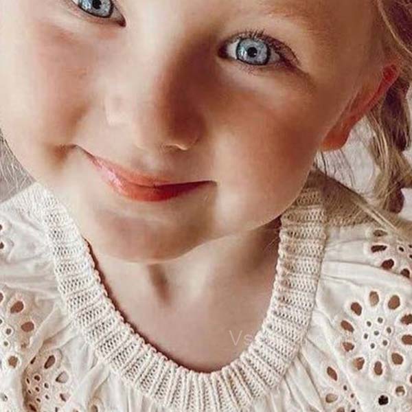 Сыпь на подбородке у ребенка Сыпь на подбородке у ребенка