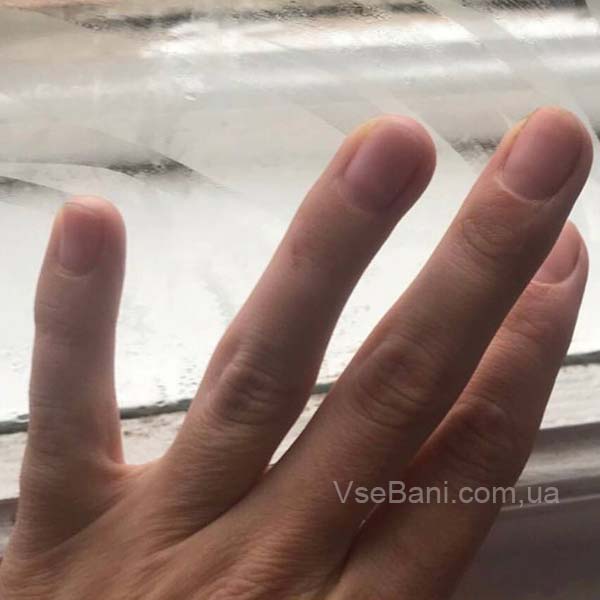 Сыпь на руках пузырчатая Сыпь на руках пузырчатая