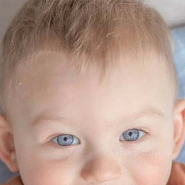 Сыпь на руках и щеках у ребенка