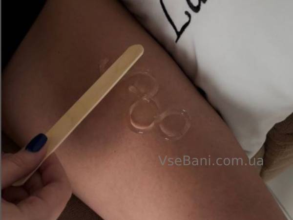 Как избавиться от прыщей на ногах