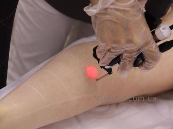 Как избавиться от прыщей на ногах