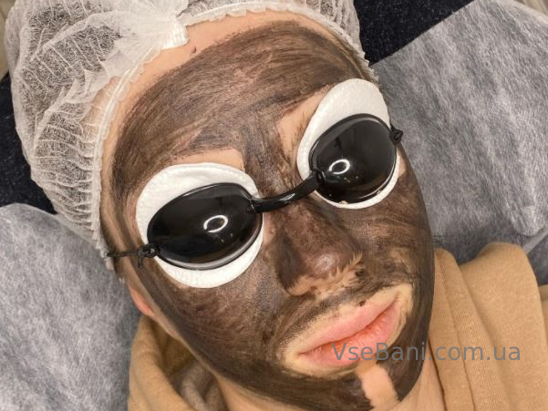 Как избавиться от подкожных прыщей Как избавиться от подкожных прыщей