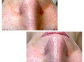 Черные точки