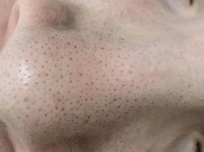 Большие черные точки