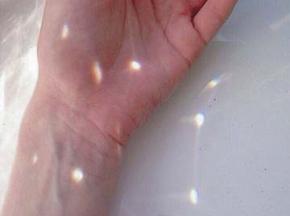 Мелкая сыпь на руках