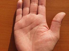 Пузырьковая сыпь на руках