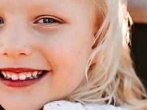 Сыпь на щеках у ребенка