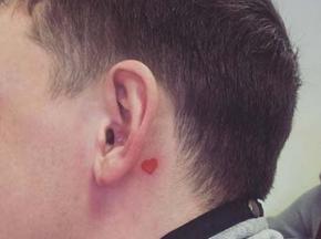 Сыпь за ушами