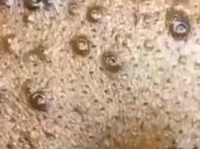 Как избавиться от черных точек на теле