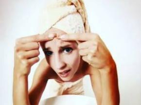 Как избавиться от прыщей на лбу