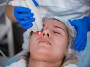 Как избавиться от пятен после акне